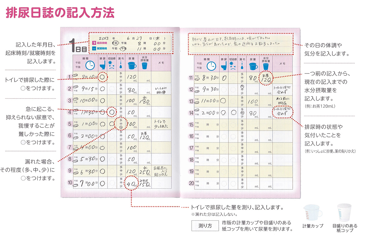 過活動膀胱の治療とチェック方法を泌尿器科が徹底して教えます - 医療法人神楽岡泌尿器科 | 北海道旭川市