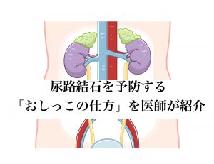 尿路結石の予防